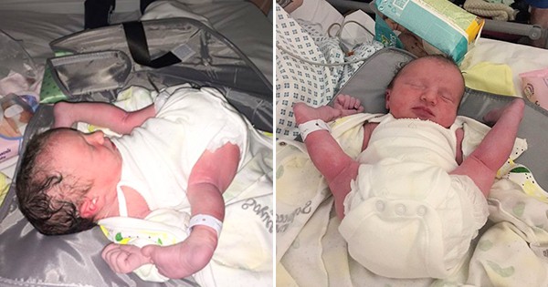 Baby Born Looking Like ‘Ready-To-Eat Counter Chicken’ With Her Legs Flung Forward And Feet Beside Her Shoulders